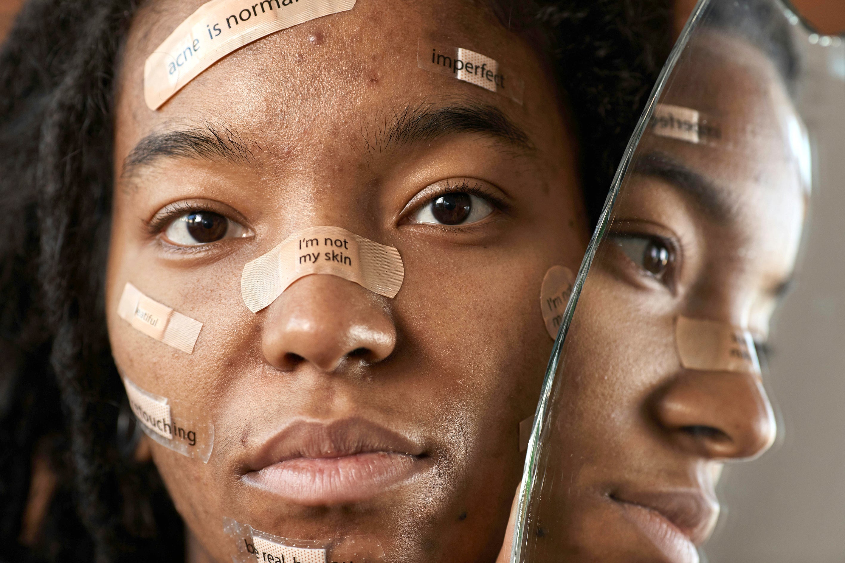 A Beginner’s Guide to Fungal Acne-Safe Korean Skincare