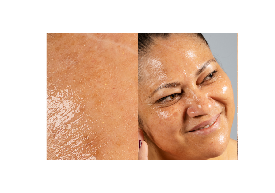 Best Korean Moisturizers for Oily Skin (2025 Guide)