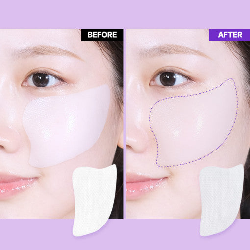 BIO HEAL BOH Probioderm 3D Lifting Voluming Patch 4+1 Set x 5