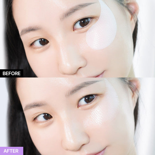 BIO HEAL BOH Probioderm Collagen Remodeling Eye Patch